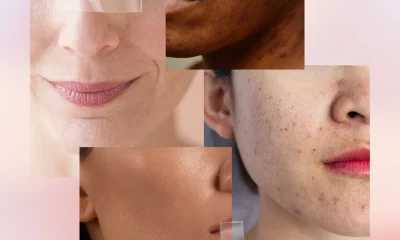 Unique Skin