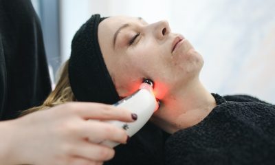 Facial Laser