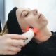 Facial Laser