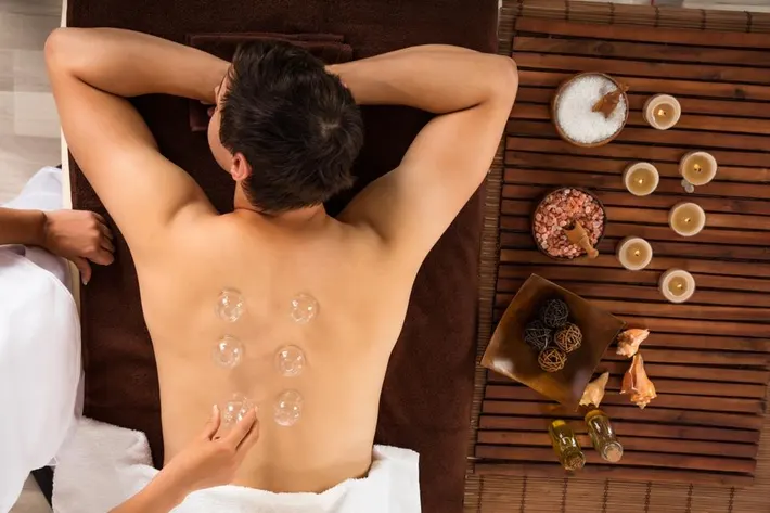 Cupping Therapy