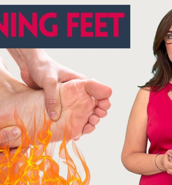 Burning Feet