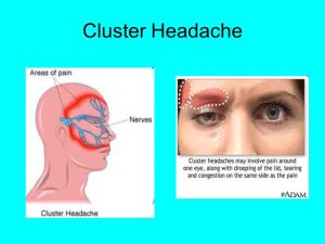  Handle Cluster Headaches