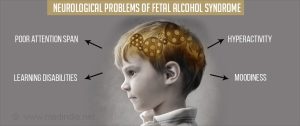 Fetal Alcohol Syndrome