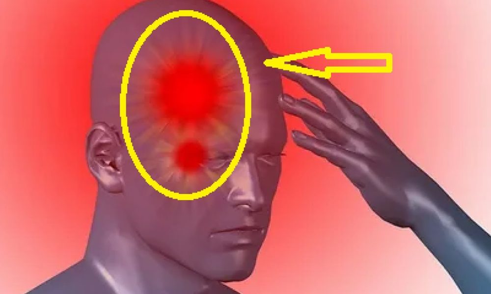 Handle Cluster Headaches