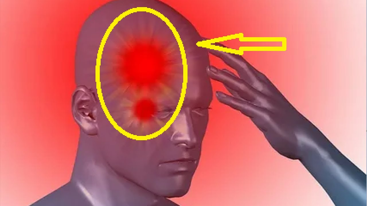 Handle Cluster Headaches