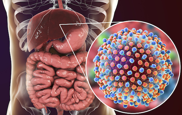 Hepatitis C Disease