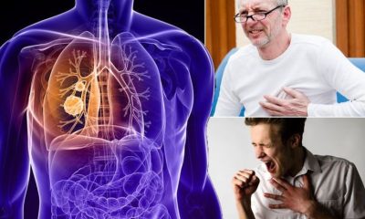 Lung Diseases