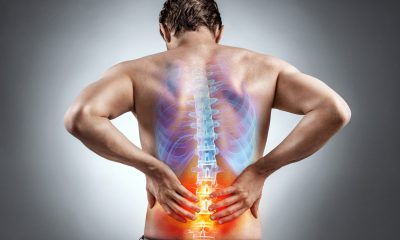 Managing Back Pain