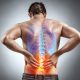 Managing Back Pain