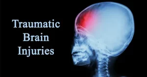 Traumatic Brain Injuries