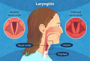  Larynx