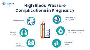 High Blood Pressure in Pregnancy