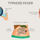 Typhoid Fever