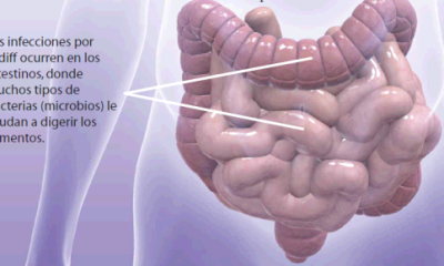 Long-Lasting C. diff Infections: A Threat to the Gut