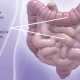 Long-Lasting C. diff Infections: A Threat to the Gut