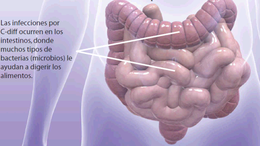 Long-Lasting C. diff Infections: A Threat to the Gut