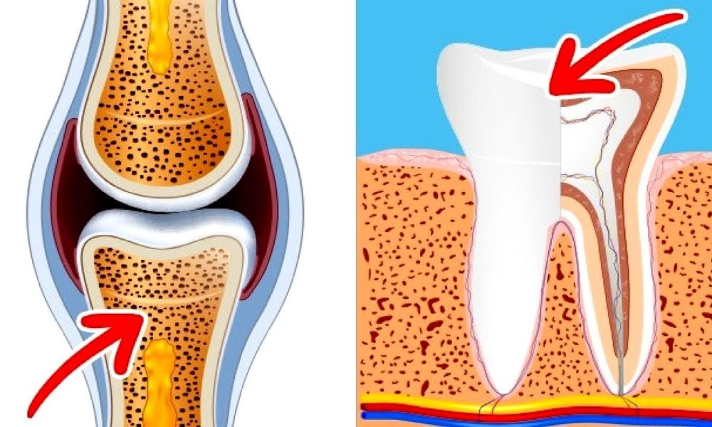 Bone and Tooth