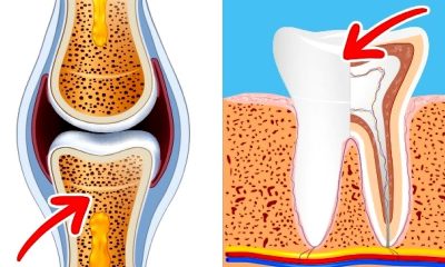 Bone and Tooth