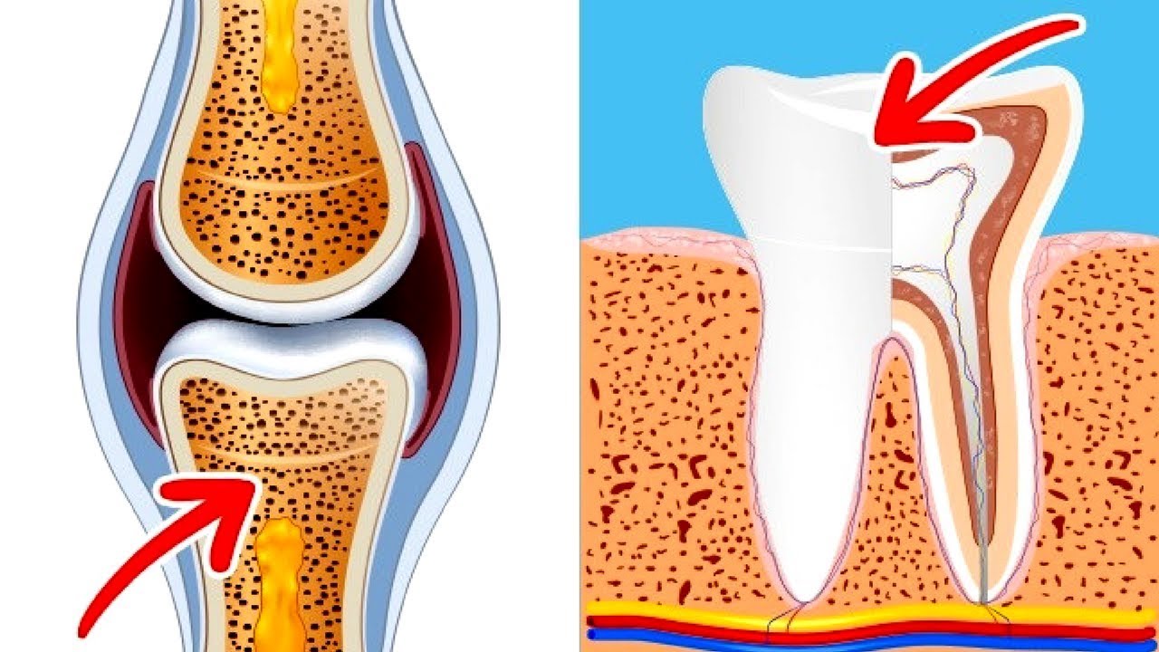 Bone and Tooth