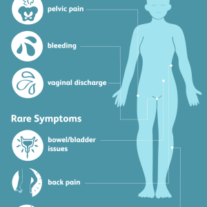 Cervical Cancer