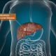 Risks of Fatty Liver