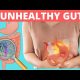 Unhealthy Gut