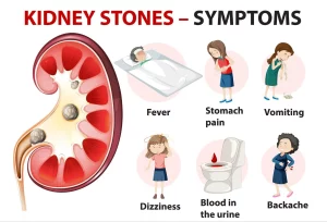  Kidney Stones