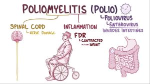 Poliovirus in Water