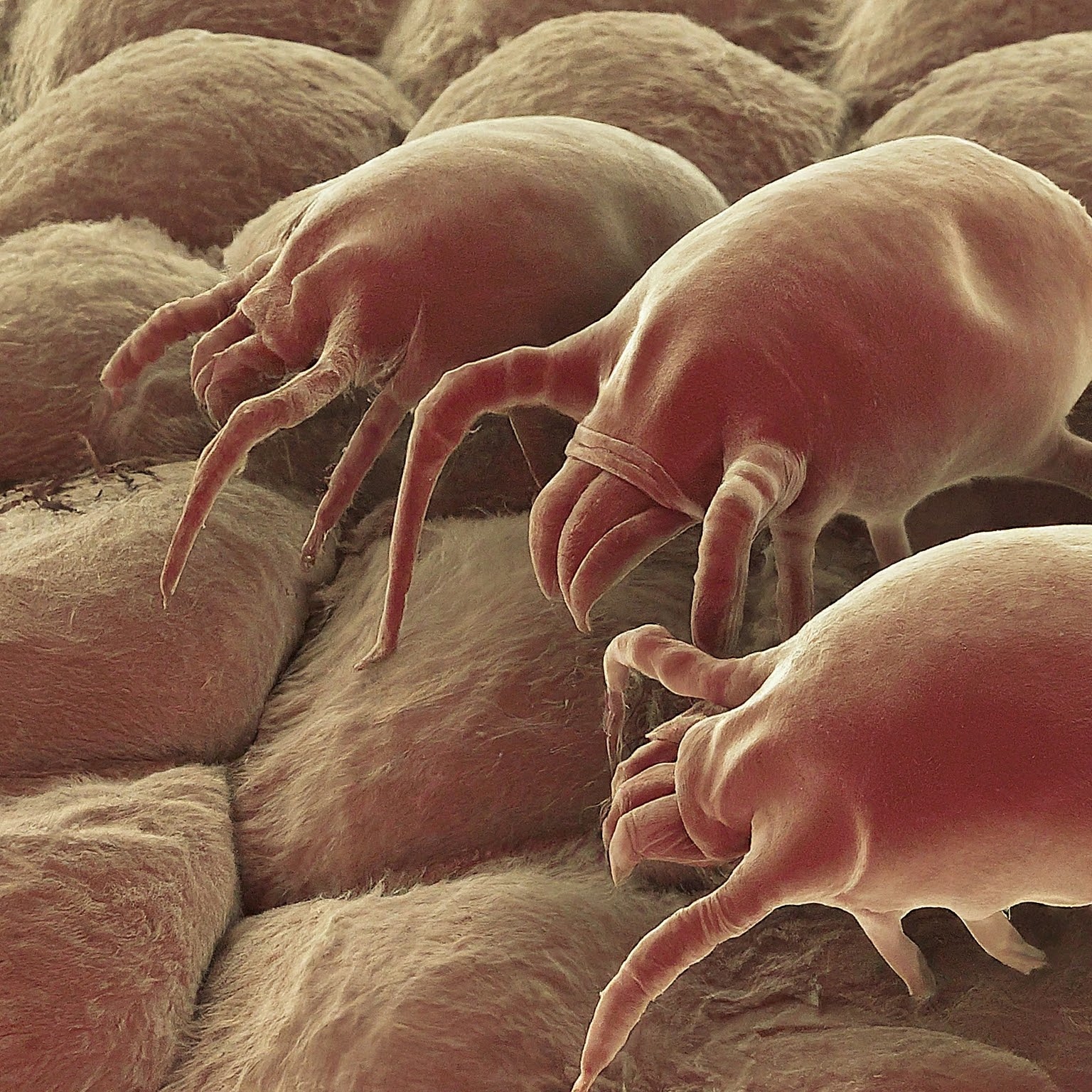 Don't Lose Sleep! Fight Pillow Dust Mites for Better Health