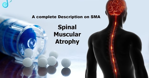 Spinal Muscular Atrophy and Liver Damage: Latest Study