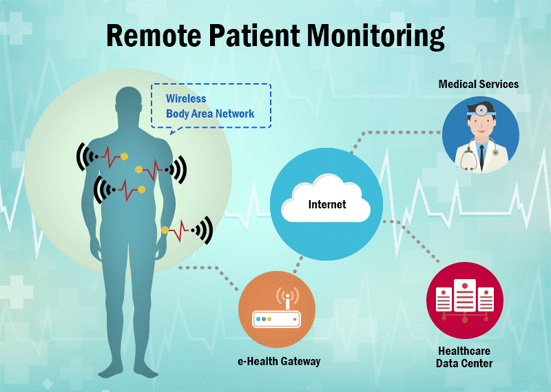 The Impact of Remote Monitoring on Patient Outcomes