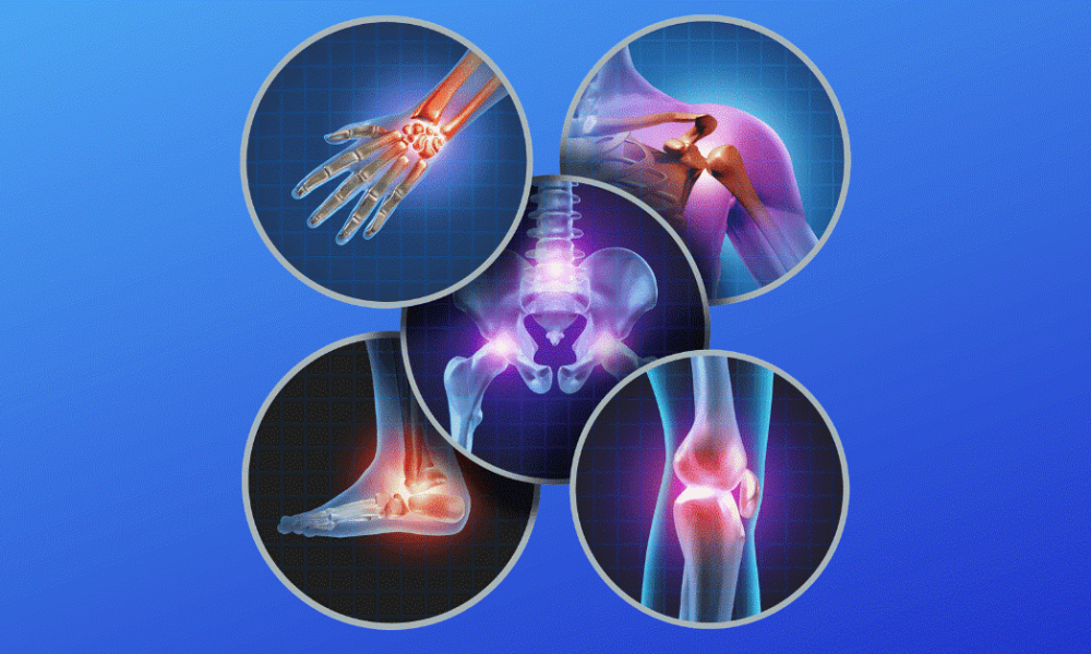 How Advances in Orthopedics Are Enhancing Joint Health