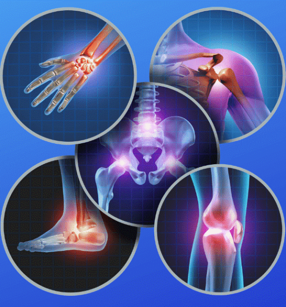 How Advances in Orthopedics Are Enhancing Joint Health