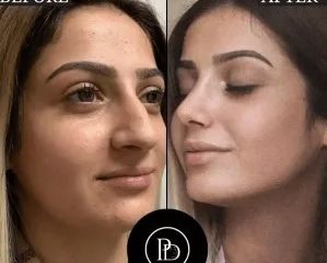 Most Recommended Best Plastic Surgeons in Dubai by Expats