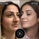 Most Recommended Best Plastic Surgeons in Dubai by Expats