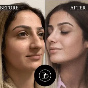 Most Recommended Best Plastic Surgeons in Dubai by Expats