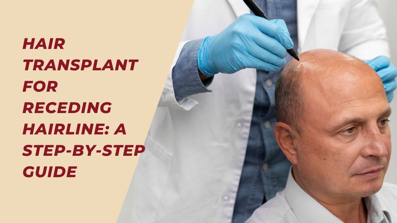 hair transplant for receding hairline