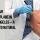 fue hair transplant los angeles