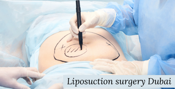 Liposuction surgery in Dubai