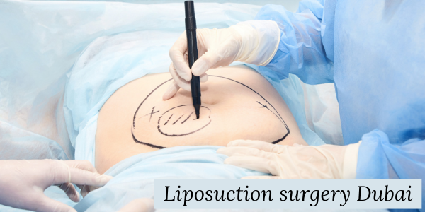Liposuction surgery in Dubai