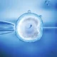 Frozen vs Fresh Embryo Transfer