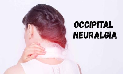 occipital neuralgia
