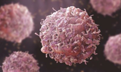 Cancer