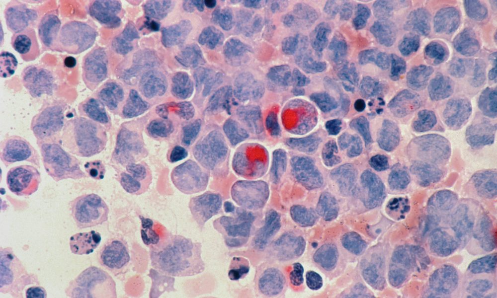 blood cancer awareness