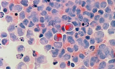 blood cancer awareness