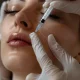 Facial Volume