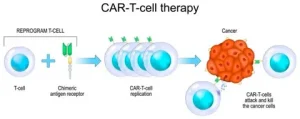 CAR-T Cell Therapy