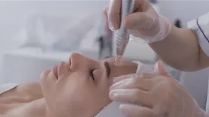 Micro Needling