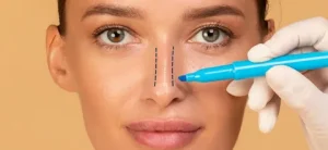 Rhinoplasty for Women