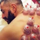 Hijama